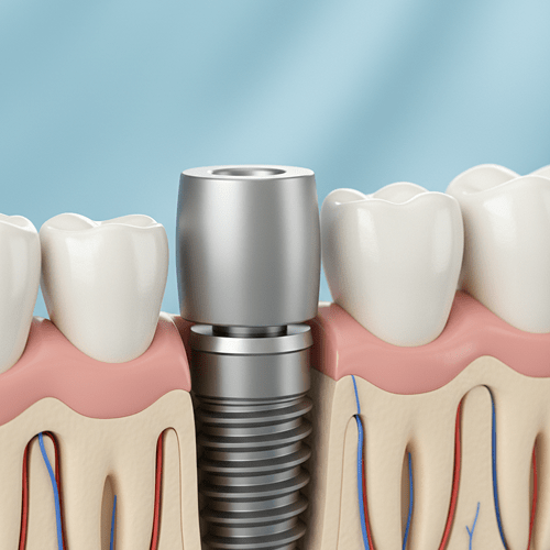 Teeth Whitening